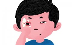 银屑病可能损伤眼睛，这些症状你有吗